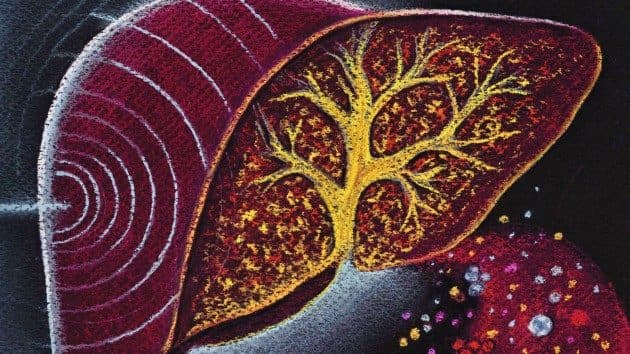 어두운 배경 위에 붉고 금빛으로 표현된 간의 양식화된 해부학 일러스트가 있는 Nature Medicine 표지 아트