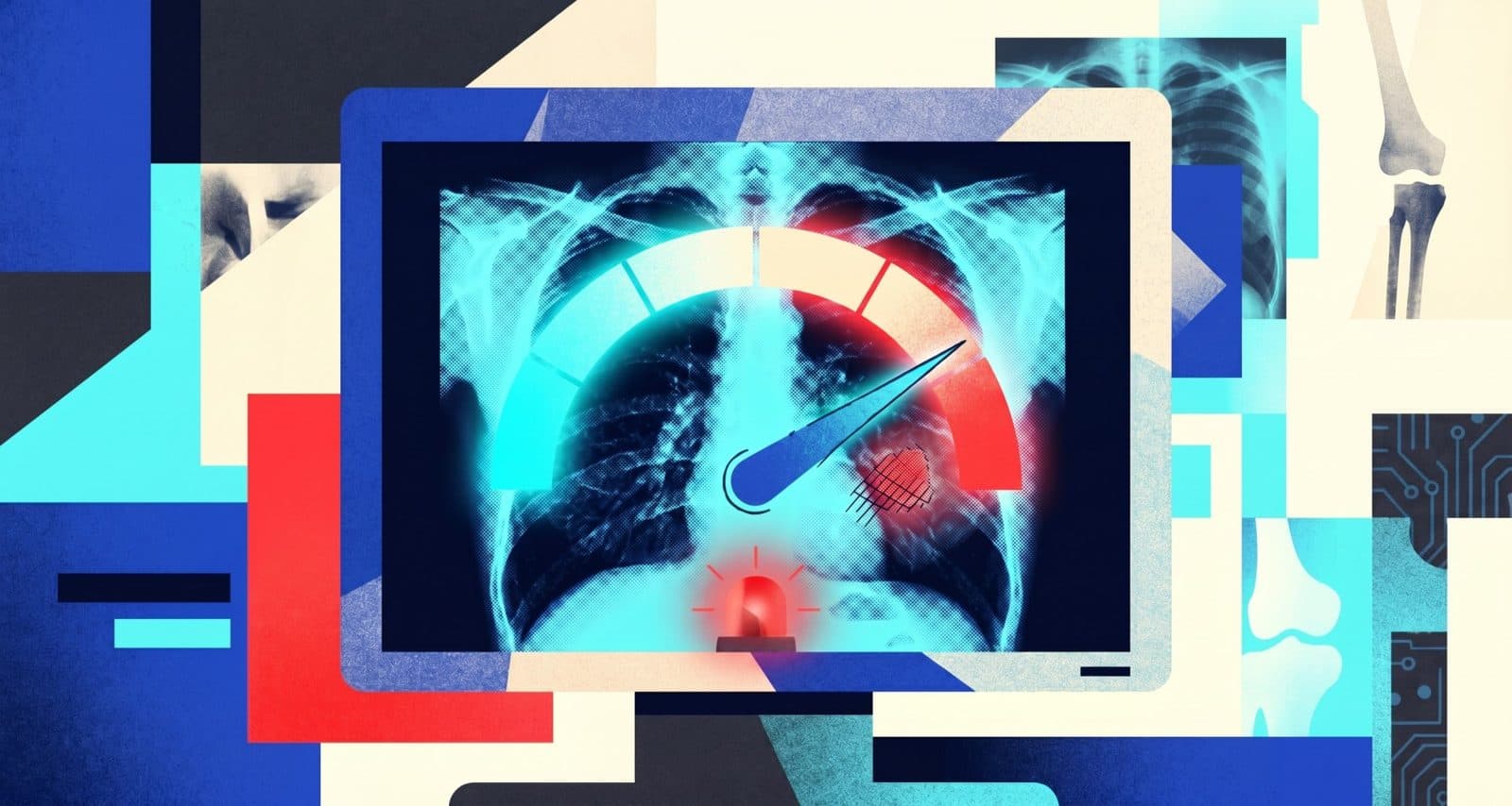 Radiografía de tórax mostrada en una pantalla